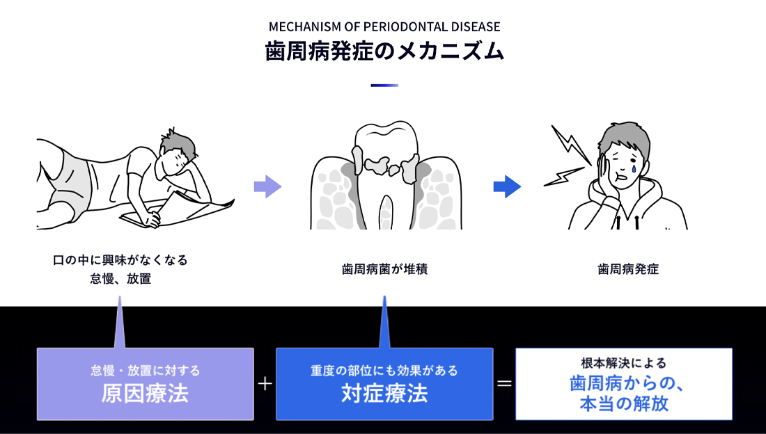 歯周病発生のメカニズム