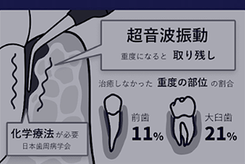 従来の治療法