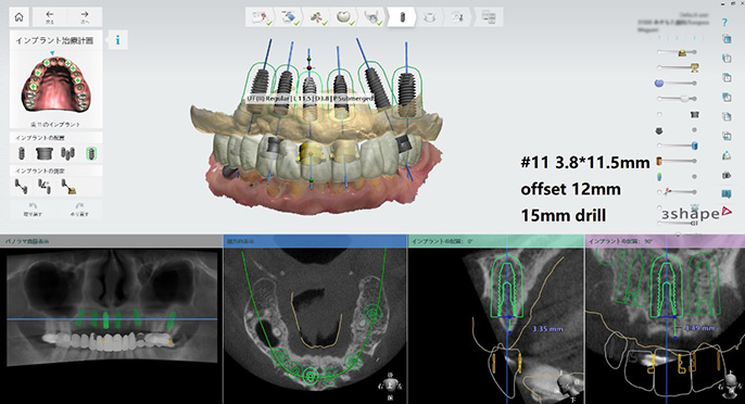 デジタルスキャン